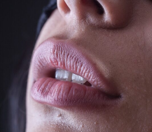 “입술이 자꾸 따갑고 붉어져요”… 립밤을 자주 바를수록 입술염이 심해진다? person with red lipstick and black mascara